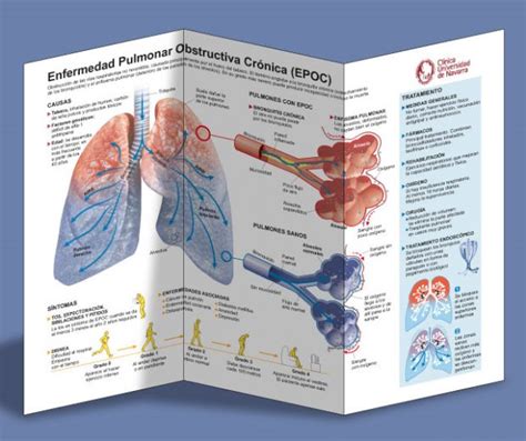 Explicar con imágenes la Enfermedad Pulmonar Obstructiva Crónica EPOC