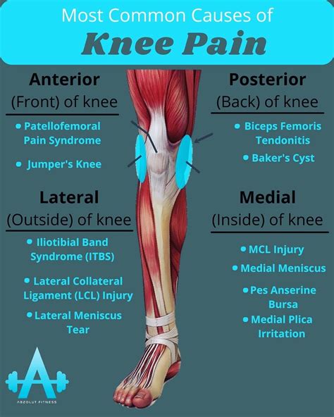 The Knee Pain Diagram Artofit