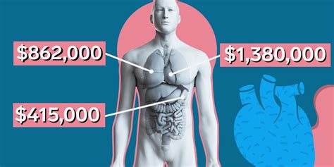 Why Organ Transplants Are So Expensive In The United States