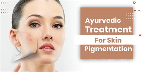 Best Ayurvedic Treatment For Skin Pigmentation Shuddhi