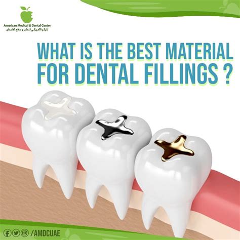 What Is The Best Material For Dental Fillings Dental Fillings