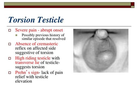 Testicular Torsion Pictures