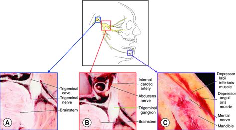 Procedure To Identify Trigeminal Ganglion In The Horizontally Sectioned