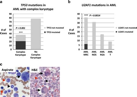 Tp53 Mutations Are Associated With Complex Karyotype Whereas U2af1