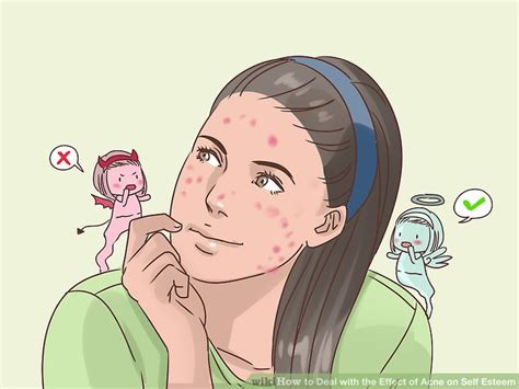 How To Deal With The Effect Of Acne On Self Esteem With Pictures