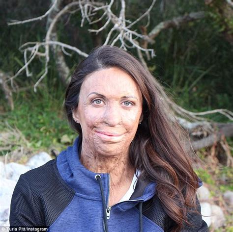 Turia Pitt Reveals How She Regained Confidence After Fire Daily Mail