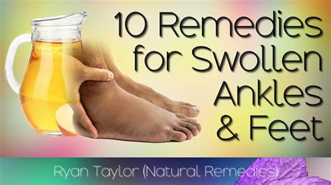 10 Home Remedies For Swollen Feet And Ankles Youtube