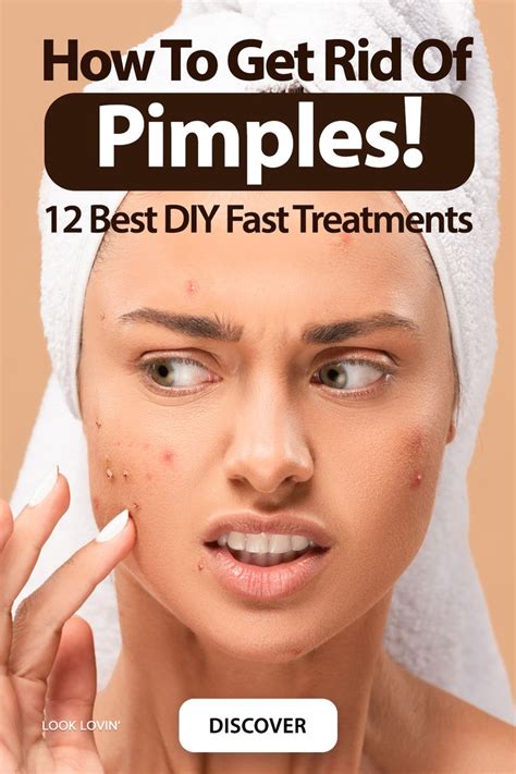 How To Get Rid Of Pimples Overnight 12 Best Diy Fast Treatments In