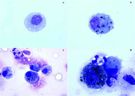 Selected Macrophages From Induced Sputum From Both Healthy Adults Are
