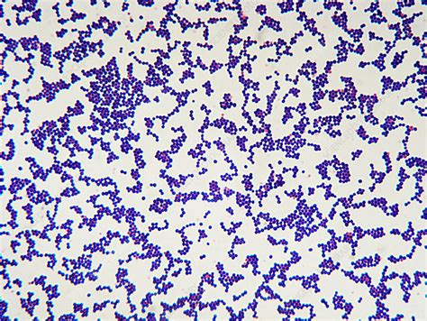 Staphylococcus Aureus Bacteria Stock Image B2340142 Science