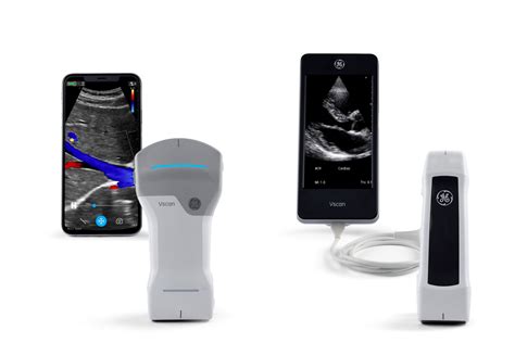 Womens Health And Obgyn Ultrasound Machine Ge Healthcare India