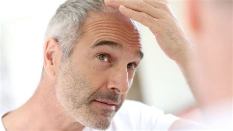 Researchers May Have Found A Miracle Cure For Baldness