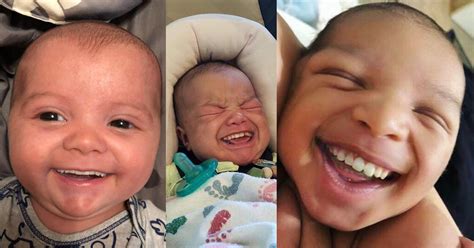 Baby Born With Full Set Of Teeth