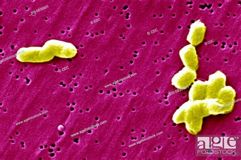 Salmonella Infantis This Scanning Electron Micrograph Sem Depicts A