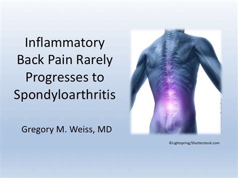 New Onset Inflammatory Back Pain What Lies Ahead
