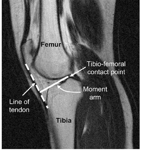 Please email baodo at stanford.edu. Knee Muscle Anatomy Mri / Use The Mouse To Scroll Or The Arrows : Mr arthrogram knee loose ...