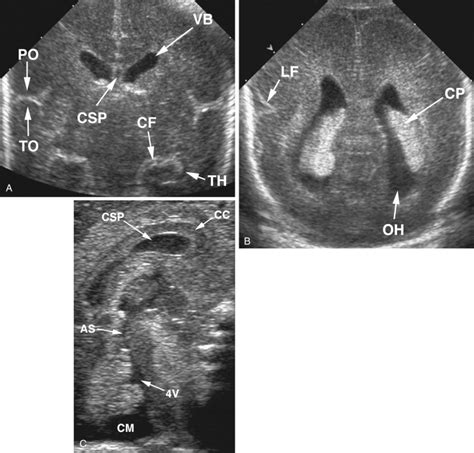 Ultrasound Evaluation Of Normal Fetal Anatomy Radiology Key