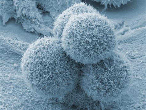 Bacteria May Play Role In Pancreatic Cancer Huffpost