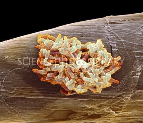 Salmonella Typhimurium Bacteria Scanning Electron Micrograph