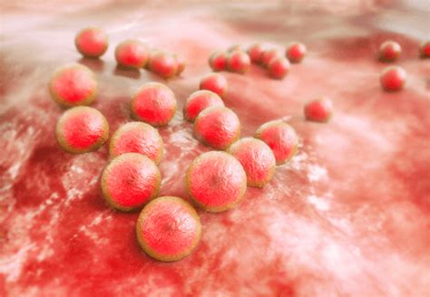 Mrsa Types Causes Symptoms Treatment And Protection Factdr