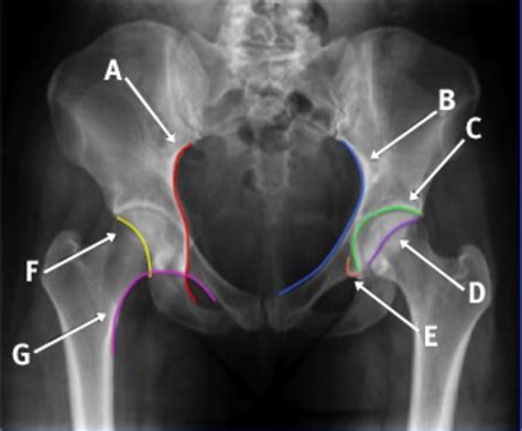 Male pelvis anatomy diagram / 94 best anatomy and. Anatomical lines of the pelvis on an anterioposterior ...