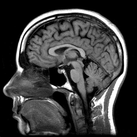 Mri Of The Brain Mri Of Trinidad And Tobago Limited