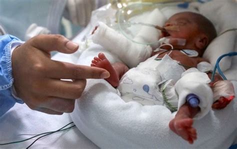 El Bebé Prematuro Que Superó El Covid 19 Luego De Una Larga Batalla