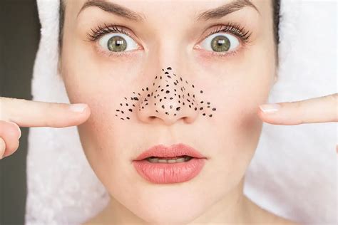 How You Can Clean Out Clogged Pores Austin Clinic