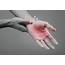The Most Common Forms Of Hand Pain  AOA Orthopedic Specialists