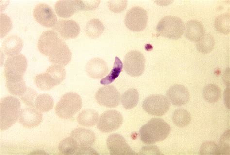 Public Domain Picture This Thin Film Blood Smear Micrograph Depicts A