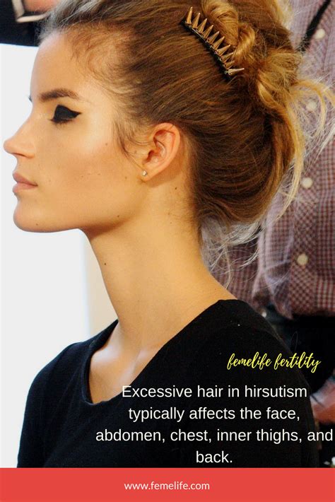 Vellus hair in men can start to grow on the head, even where for many years was bald. Pin on Hormones