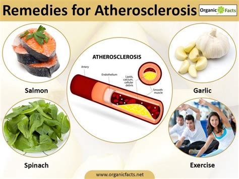 Some Of The Most Important Home Remedies For Atherosclerosis Include The Use Of Avoiding Meat