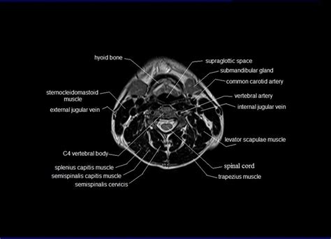 Mri Head And Neck Anatomy