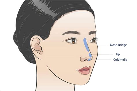 How To Correct The Shape Of The Nose With Dermal Filler Injections