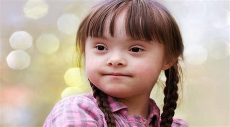 Penyebab Down Syndrome Menurut Para Ahli Salam Sehat
