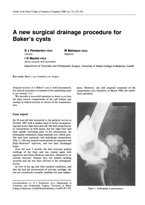 Baker S Cyst Drainage Procedure Best Drain Photos Primagemorg