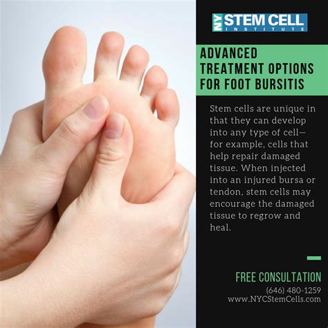 Do You Suffer From Foot Bursitis Podiatrists New York City Stem Cells Stem Cell Therapy