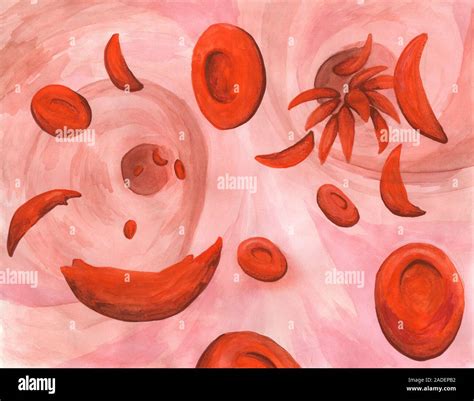 Las Células Falciformes En Vasos Sanguíneos Ilustración Las Células
