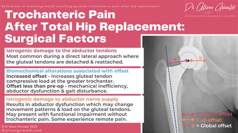 Greater Trochanteric Pain After Hip Replacement Find Out More
