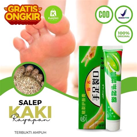salep kutu air di tangan