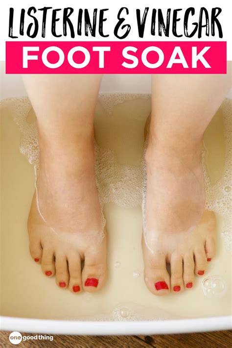 This Listerine Foot Soak Cures Dry Heels Foot Soak Vinegar Listerine
