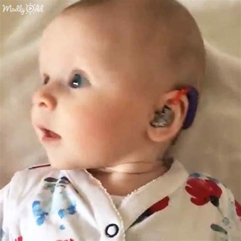 Deaf Baby Squeals With Delight Upon Hearing Her Mothers Voice For The
