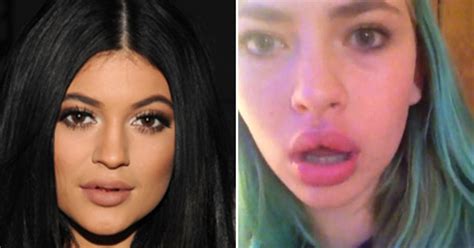 How To Get Kylie Jenner Lips With A Bottle Cap Lipstutorial Org
