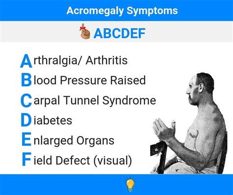 acromegaly nursing care plan and management rnpedia nursing care plan ob nursing nursing