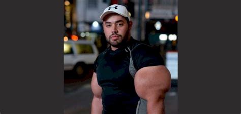Real Life Popeye Has Massive 31 Inch Biceps
