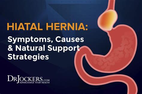Hiatal Hernia Symptoms Causes And Natural Support Strategies Hernia