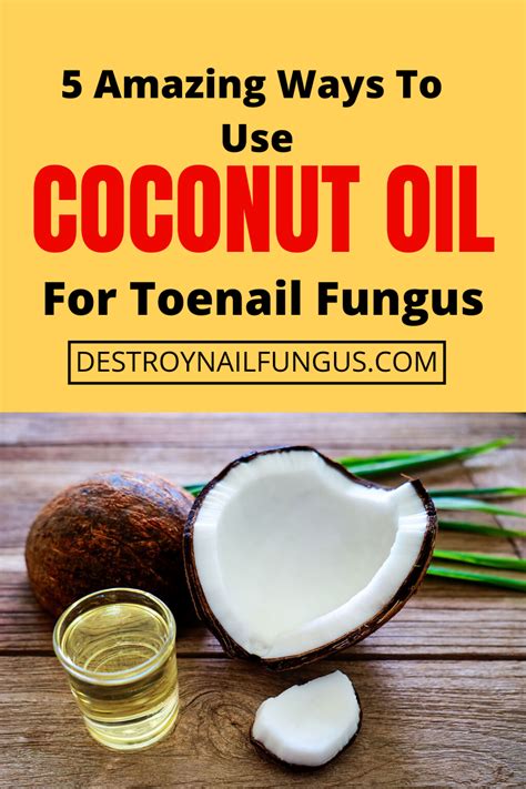 As such, it can treat toenail fungus rather effectively. 5 Amazing Ways To Use Coconut Oil For Toenail Fungus ...