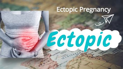 Laparoscopic Management Of Ectopic Pregnancy Youtube