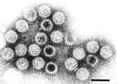 Rotavirus diarrhea in selected african countries: Figure 1 - Rotavirus - Volume 4, Number 4—December 1998 - Emerging Infectious Diseases journal - CDC