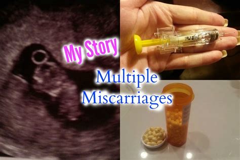 My Multiple Miscarriage Story Overcoming Recurrent Pregnancy Loss Youtube